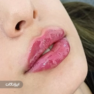 کلینیک زیبایی لئا